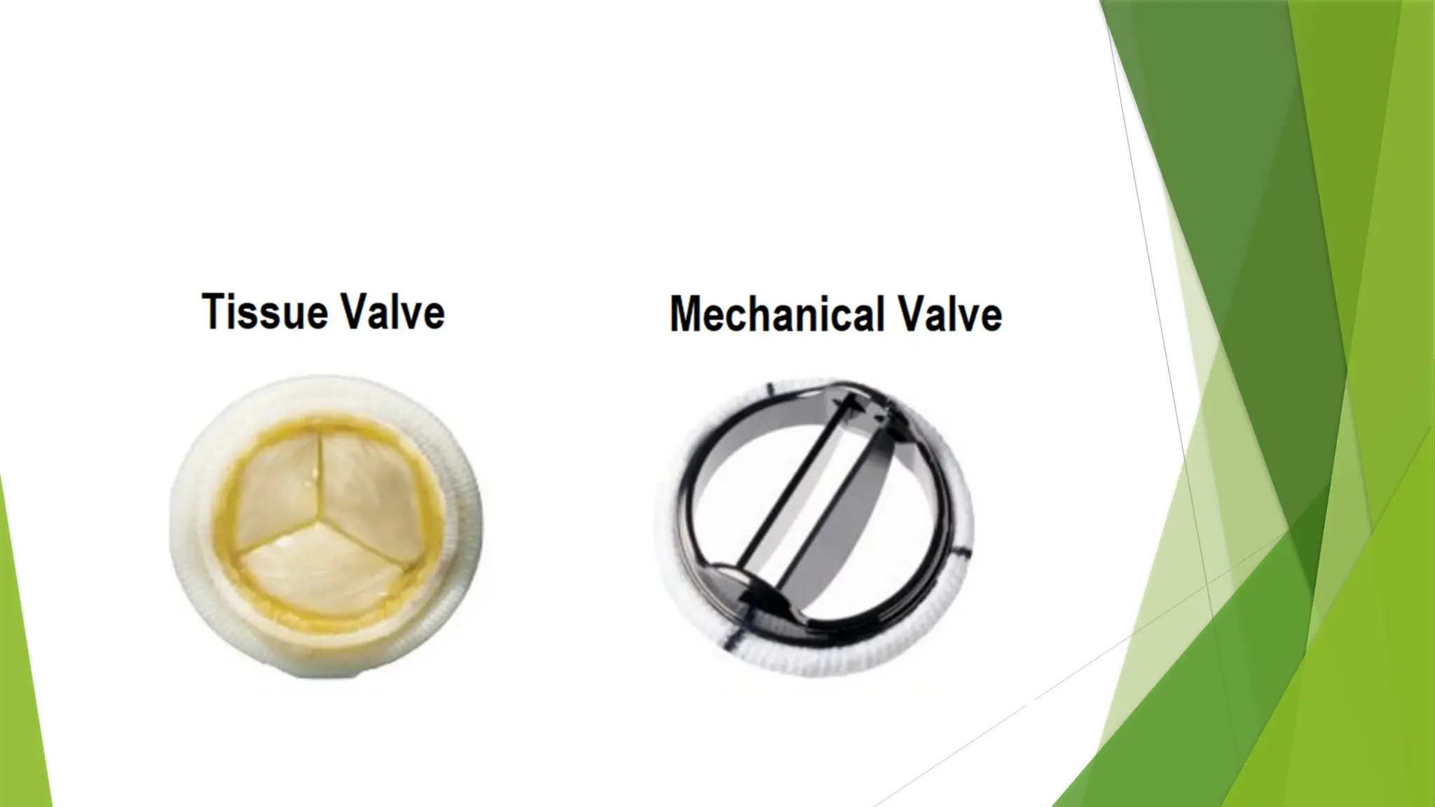 Aortic stenosis is one of the most common and most serious valve disease problems.